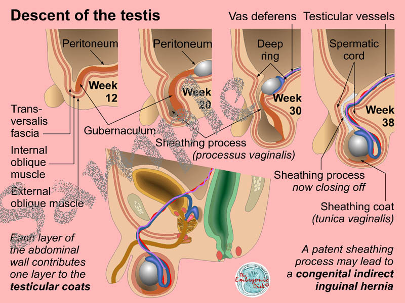 Descent of the testis