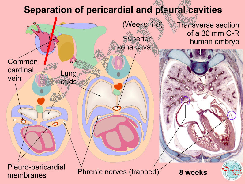 Separation of pericardial and pleural cavities