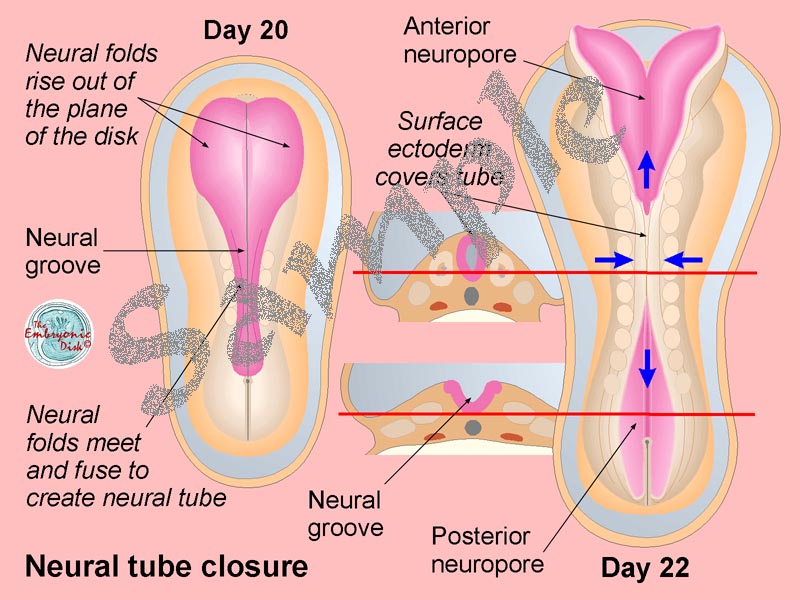 Neural tube closure