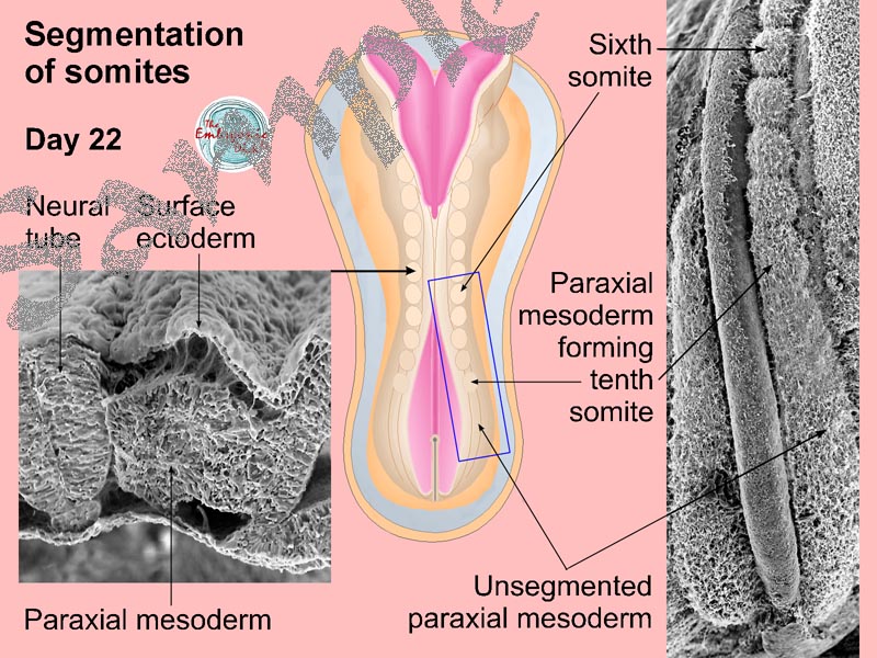 Segmentation of somites