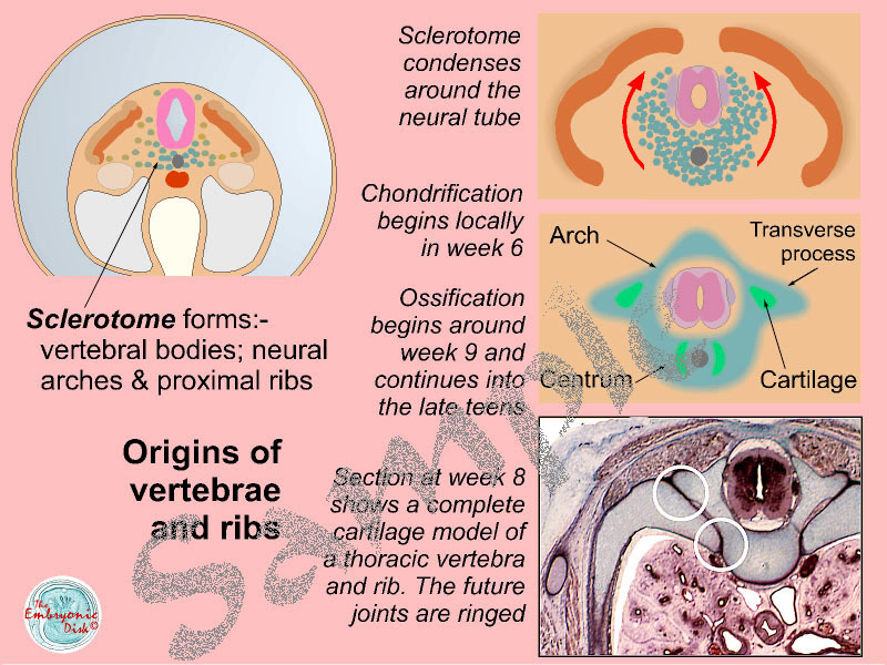 Origins of vertebrae and ribs