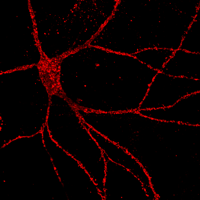 hippocampal neuron