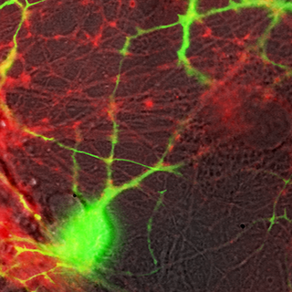 neuronal culture tagged with FM 4-64 and transgenic GFP