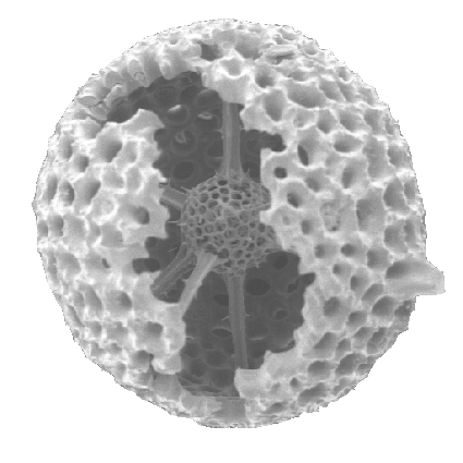 spumellarian Radiolaria showing medullary shell