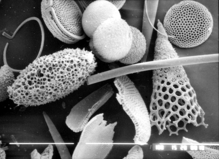 SEM image of radiolaria, foraminifera and diatoms