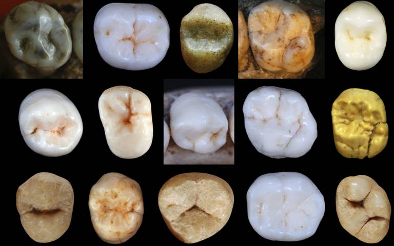 Neanderthals and modern humans teeth Dr Aida Gomez-Robles UCL Anthropology