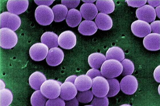 1280px-Staphylococcus_aureus_VISA_2.jpg
