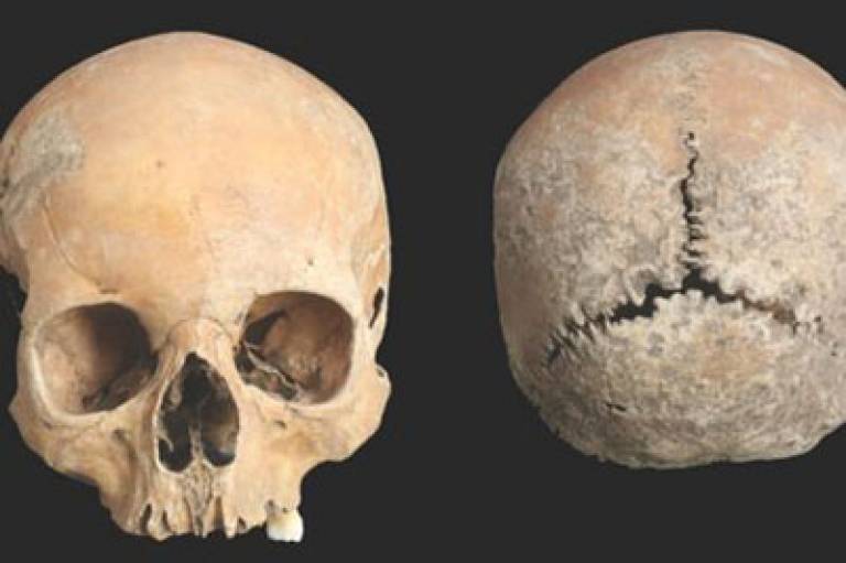 Skull of young girl showing evidence of mutilation (Image by Garrard Cole, courtesy of Antiquity) 