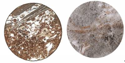 Archaeological soil micromorphology (microscopic image)