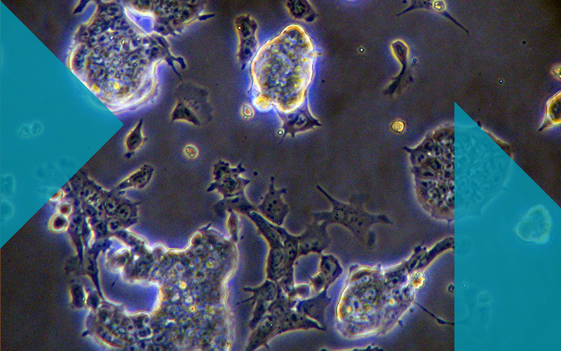 UCL Biochemical Engineering cells on slide with filter