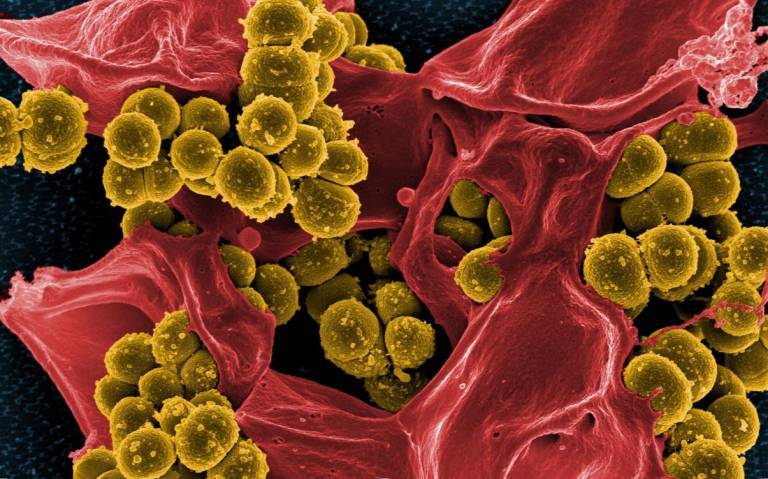 Scanning electron micrograph of Methicillin-resistant Staphylococcus aureus (MRSA) and a dead Human neutrophil