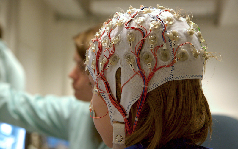 brain monitor cap
