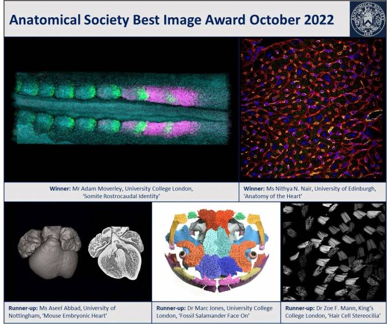 Anatomy Society image prize winners