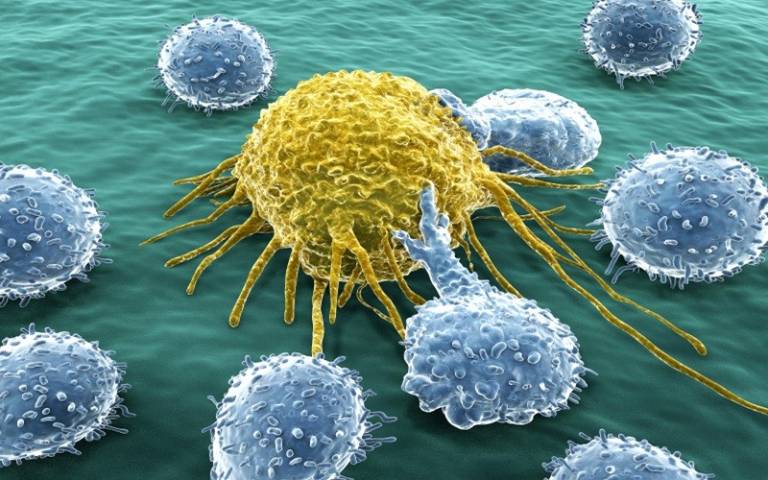 Cancer cell with lymphocytes