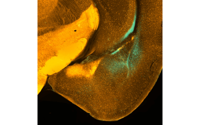mouse brain centered on the amygdala, with hippocampus -projecting neurons in cyan and inhibitory neurons in orange