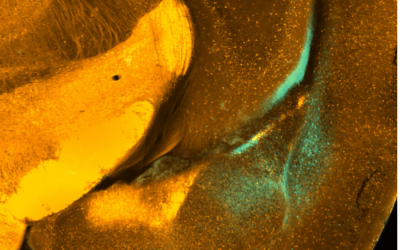 mouse_brain_centered_on_the_amygdala_with_hippocampus_-projecting_neurons_in_cyan_and_inhibitory_neurons_in_orange