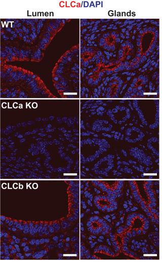 Clathrin light chains CLCa and CLCb have non-redundant roles in epithelial lumen formation