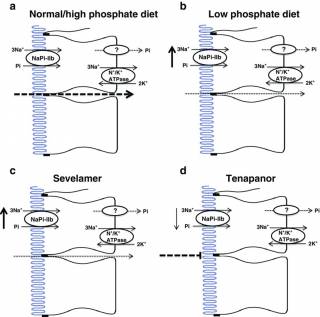 The role of SLC34A2 in intestinal phosphate absorption and phosphate homeostasis