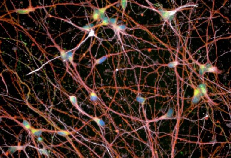 Human stem cell derived spinal motor neurons