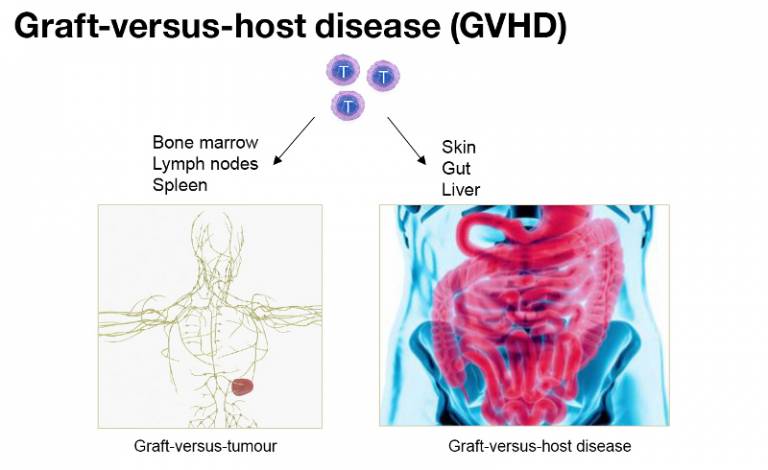 Graft-versus-host-disease