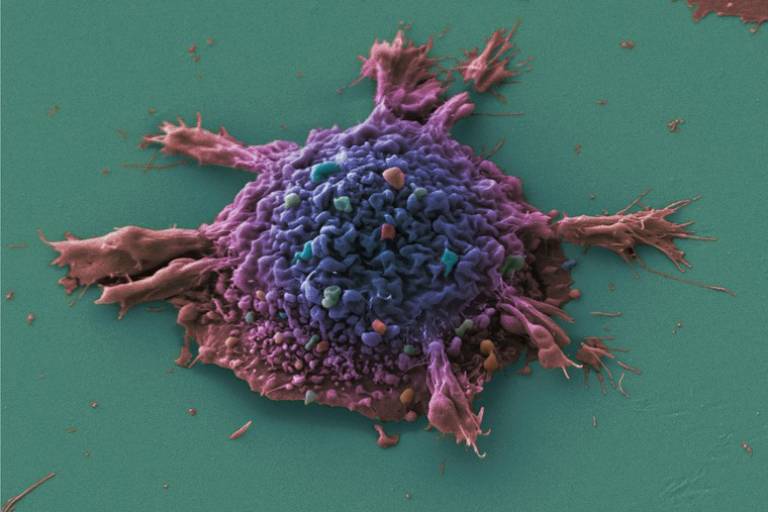 Lung Cancer Cell
