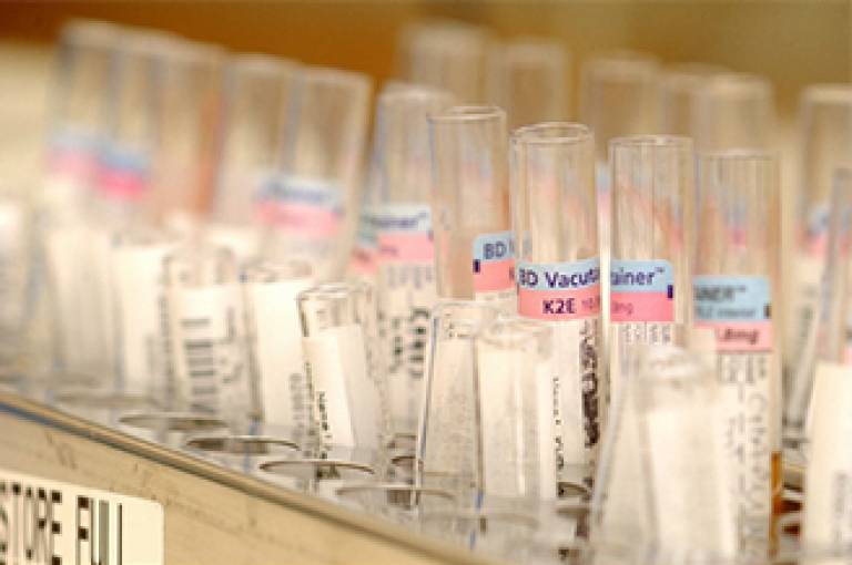 Wellcome images blood test tubes…