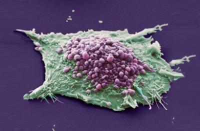 lung cancer cells…