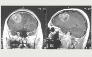 Scan of human brain