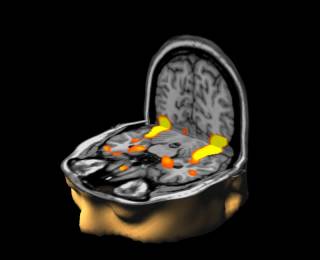 fMRI brain image