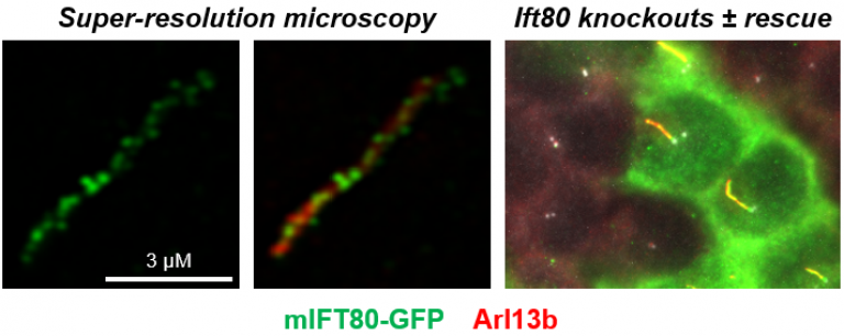 image of super-resolution microscopy and Ift80 knockouts + rescue