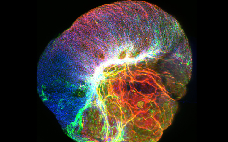 Vibrant images showcase key moments of discovery in UCL research