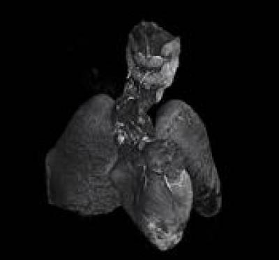Postmortem microCT imaging of a fetal heart and lungs