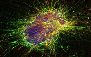 Human Derived neurons