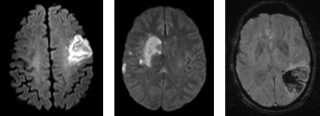 MRI Scan Image