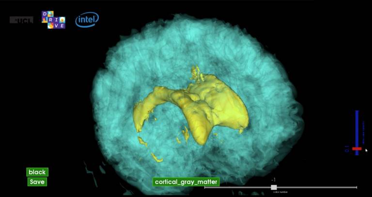 Holographic image of brain ventricle. See www.holorepository.com