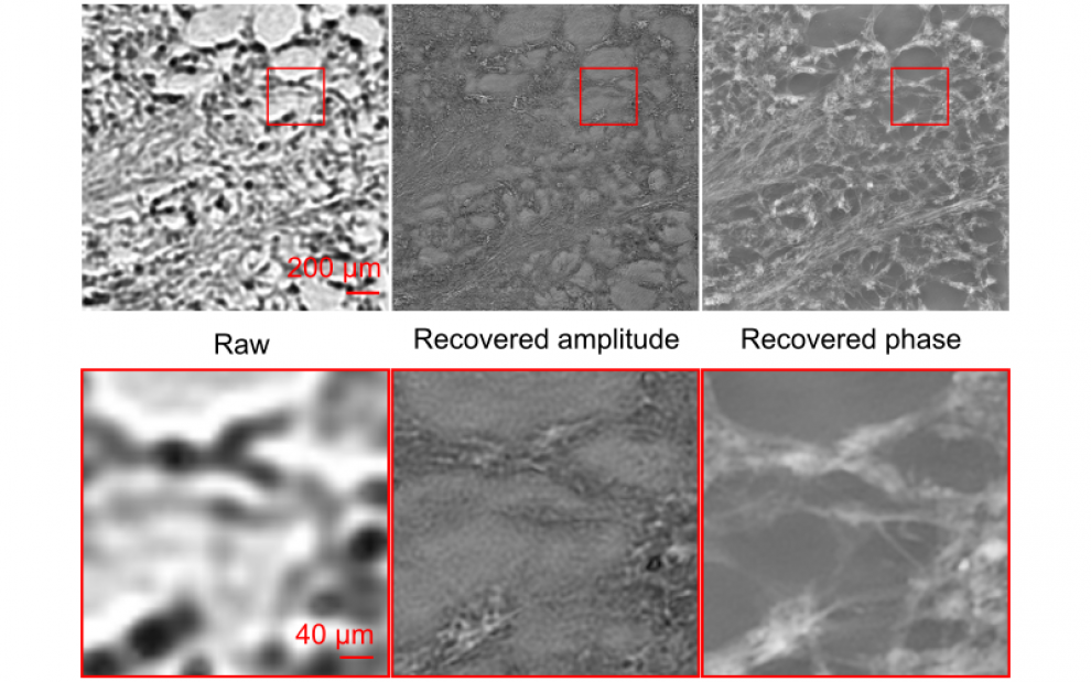 Raw (left) and high-resolution amplitude (centre) and phase images of a tissue section captured using FPM.