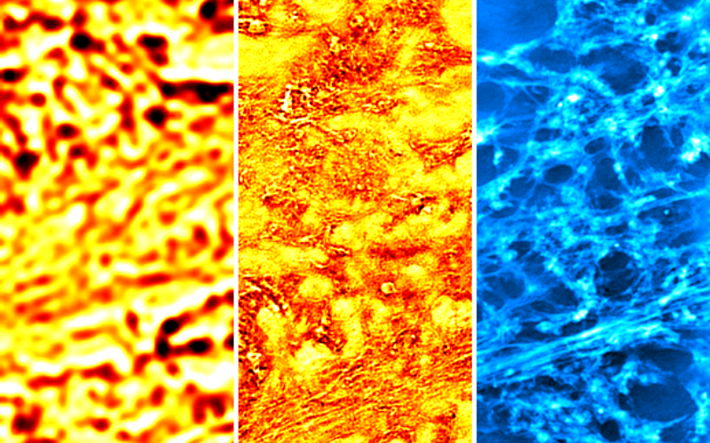 Triptych of false colour images of a tissue section computed from a Fourier ptychographic microscopy image series. Left panel shows conventional brightfield micrograph and centre and right panels show and high resolution reconstructed amplitude and phase 