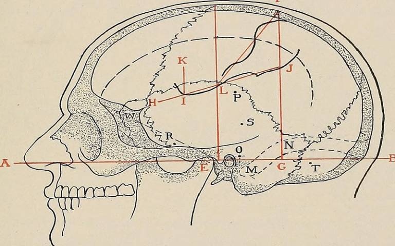 A diagram showing the brain