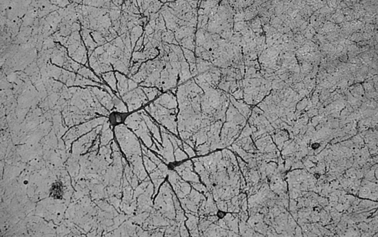 Monochrome image of neurons from a mouse brain. 