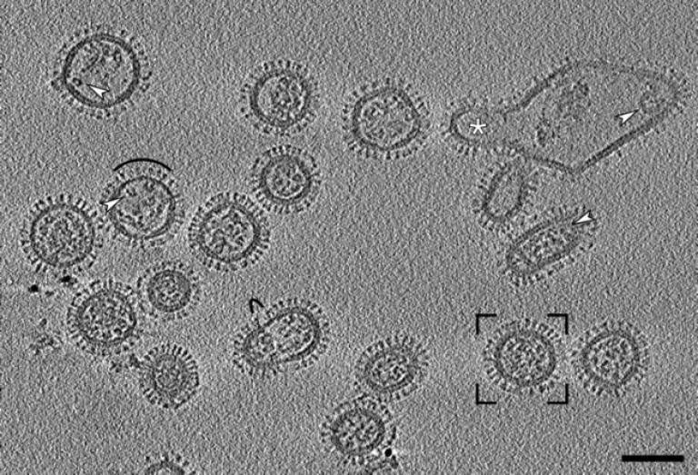 image of influenza virus under a microscope