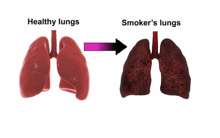 On the left hand side is an image of a pair of lungs, they are pink and glossy. On the right is an image of a pair of lungs that are black and speckled with black lines. Text from left to right says healthy lungs, smoker's lungs. 