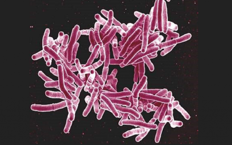 Image of tuberculosis as seen under a microscope. The disease looks like pink rod shapes. 