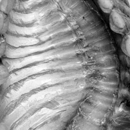 Specimen showing a deformed thorax and curved spine
