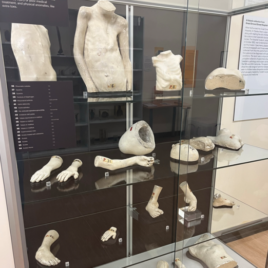 Casts from the UCL Pathology Collections