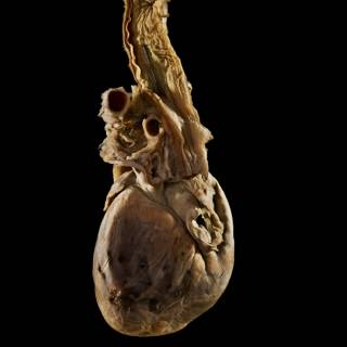 A heart and oesophagus specimen photographed against a black background