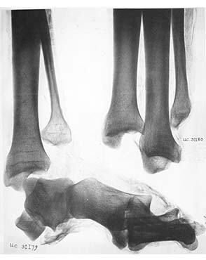 X-ray of bones from Deshasheh. Petrie, Deshasheh: 1897: pl. XXXVII.