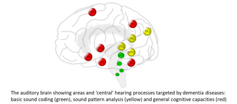 Auditory and nonverbal cognition