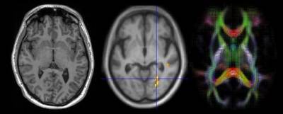 Brain images obtained using magnetic resonance imaging…