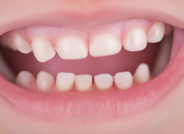 Generated images of health child's mouth teeth showing and smiling