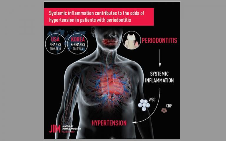 Graphic illustrating the connection between periodontitis and hypertension